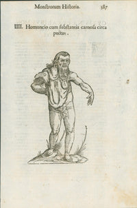 Aldrovandi — Seven Folio Leaves of Human Deformities and Monstrosities from the Monstrorum Historia, Bologna 1640 - Lumenrare Antique Prints & Maps