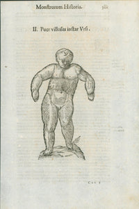Aldrovandi — Seven Folio Leaves of Human Deformities and Monstrosities from the Monstrorum Historia, Bologna 1640 - Lumenrare Antique Prints & Maps