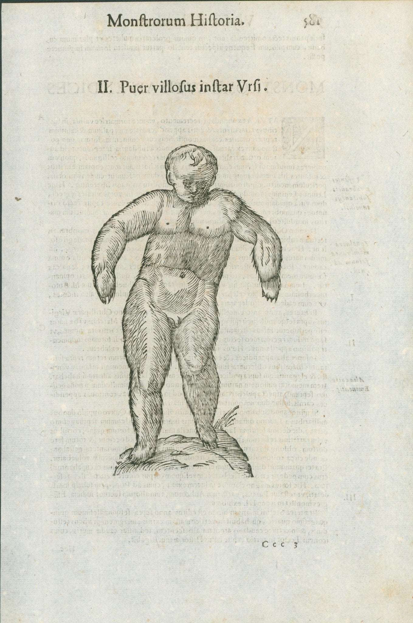 Aldrovandi — Seven Folio Leaves of Human Deformities and Monstrosities from the Monstrorum Historia, Bologna 1640 - Lumenrare Antique Prints & Maps