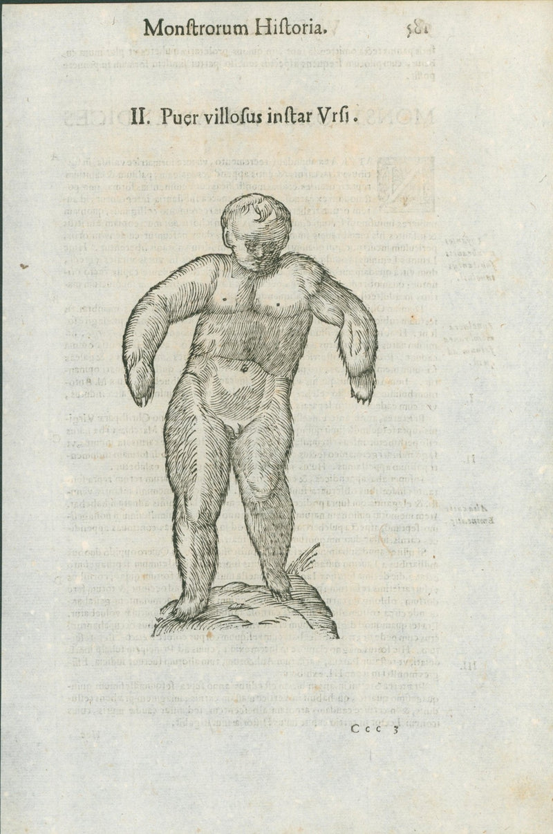 Aldrovandi — Seven Folio Leaves of Human Deformities and Monstrosities from the Monstrorum Historia, Bologna 1640 - Lumenrare Antique Prints & Maps