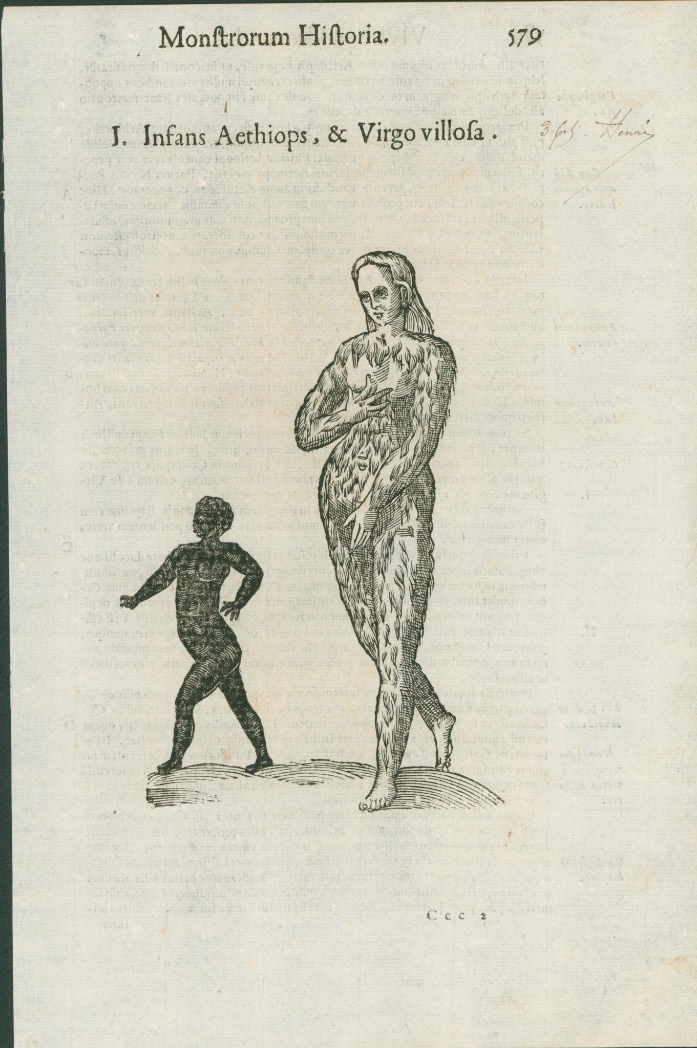 Aldrovandi — Seven Folio Leaves of Human Deformities and Monstrosities from the Monstrorum Historia, Bologna 1640 - Lumenrare Antique Prints & Maps