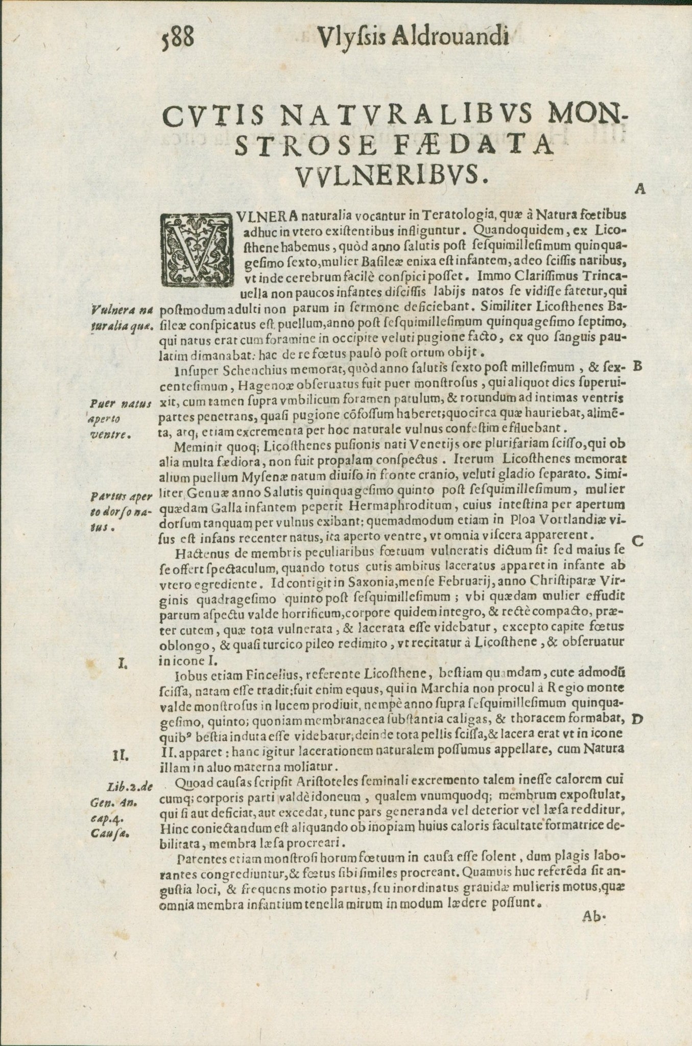 Aldrovandi — Seven Folio Leaves of Human Deformities and Monstrosities from the Monstrorum Historia, Bologna 1640 - Lumenrare Antique Prints & Maps